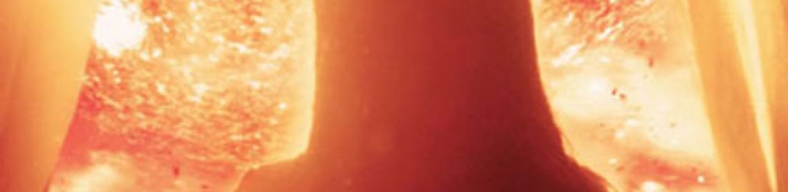 Exploding Sun